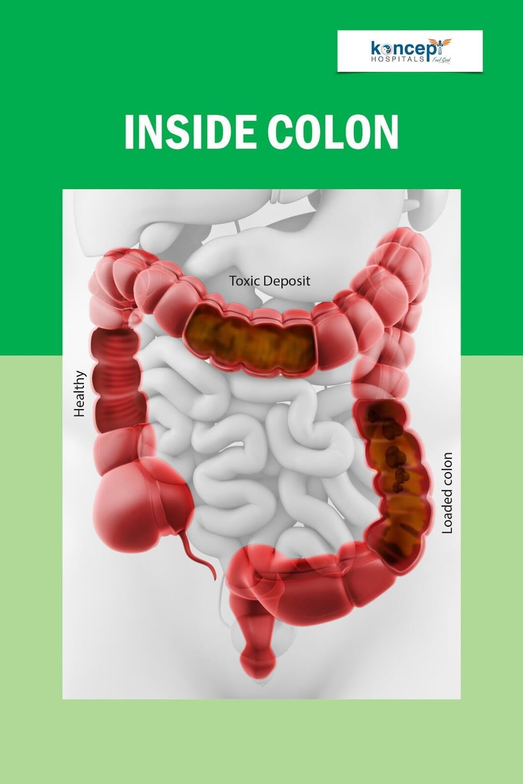 Intestine cleaning on sale